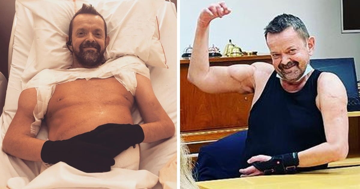 Read more about the article Mężczyzna, który jako pierwszy na świecie przeszedł przeszczep rąk, inspiruje do pokonywania życiowych przeszkód